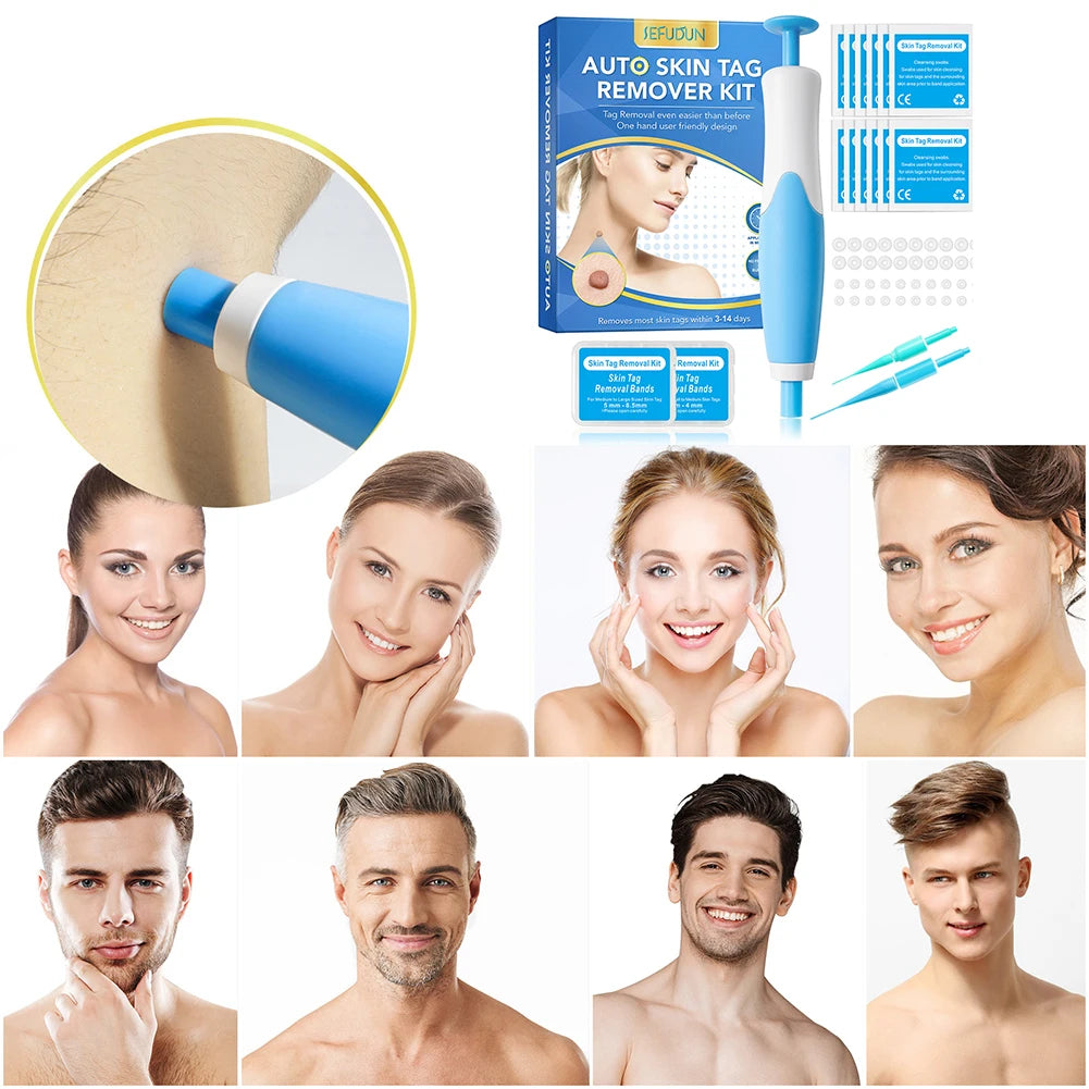 105 - Face Mole Removal Tool Kits Rubber Rings Face Beauty Accessories Wart Tag Remover Kit Multipurpose Supplies for Armpits Arm Legs